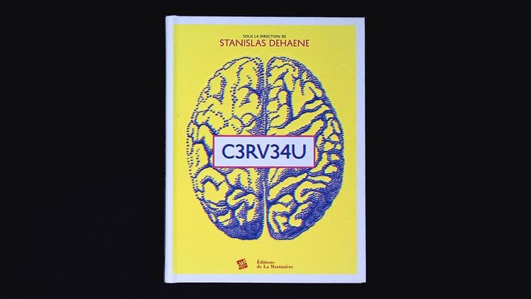 abmstudio-site-cerveau-1.jpg