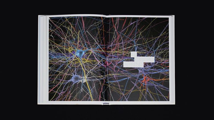 abmstudio-site-cerveau-3.jpg