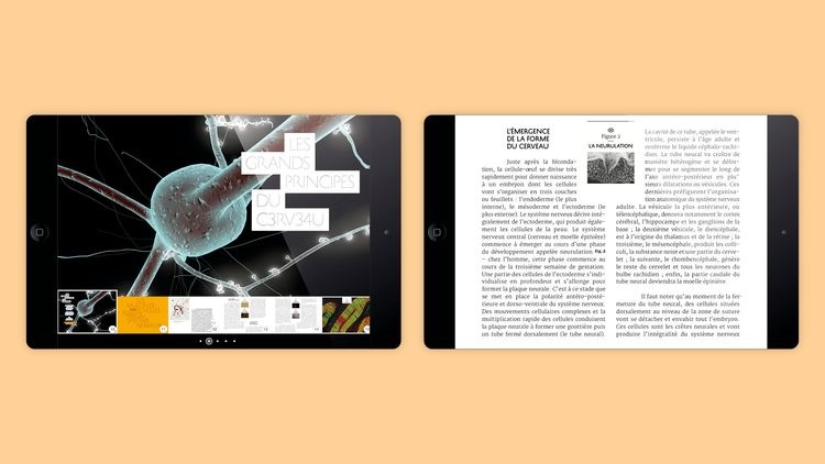 abmstudio-site-cerveau-5.jpg
